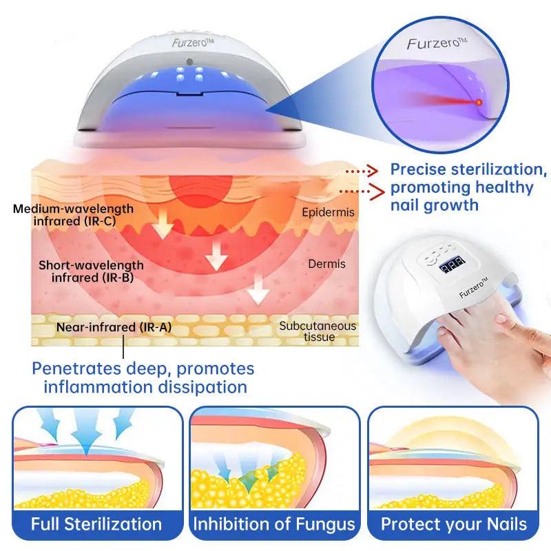 Fungus Laser Therapy Device - ACO Marketplace