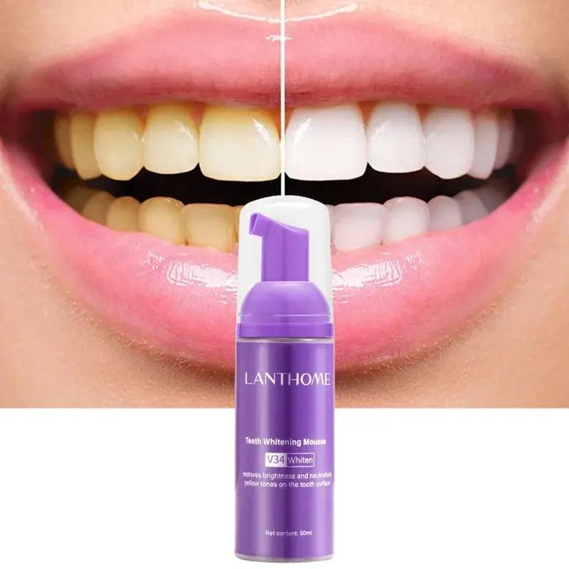 Mousse Toothpaste Teeth Whitening - ACO Marketplace