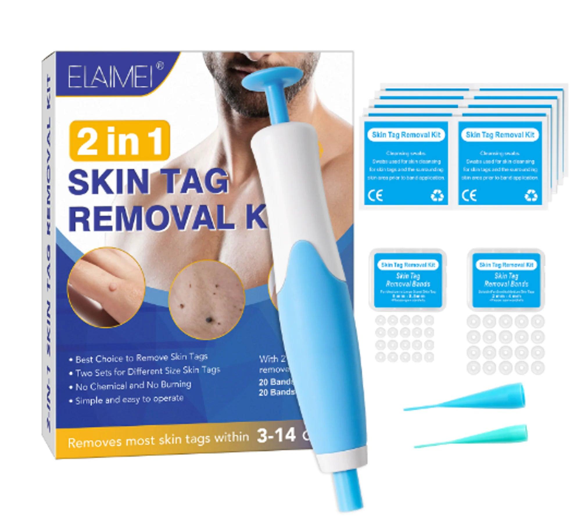 Revolutionary Automatic Skin Tag Removal Kit - ACO Marketplace