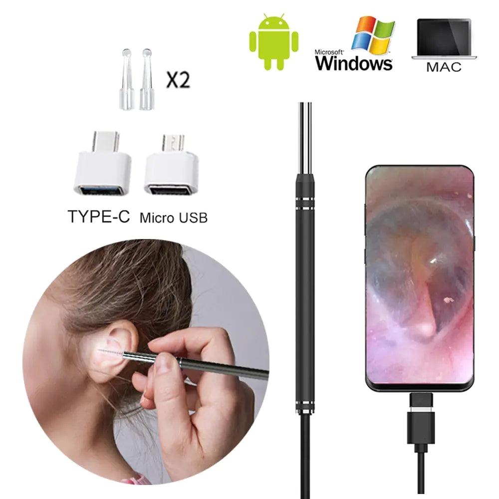 Smart Earwax Removal Tool w/ Camera - ACO Marketplace
