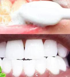 Tooth Whitening Mousse - ACO Marketplace